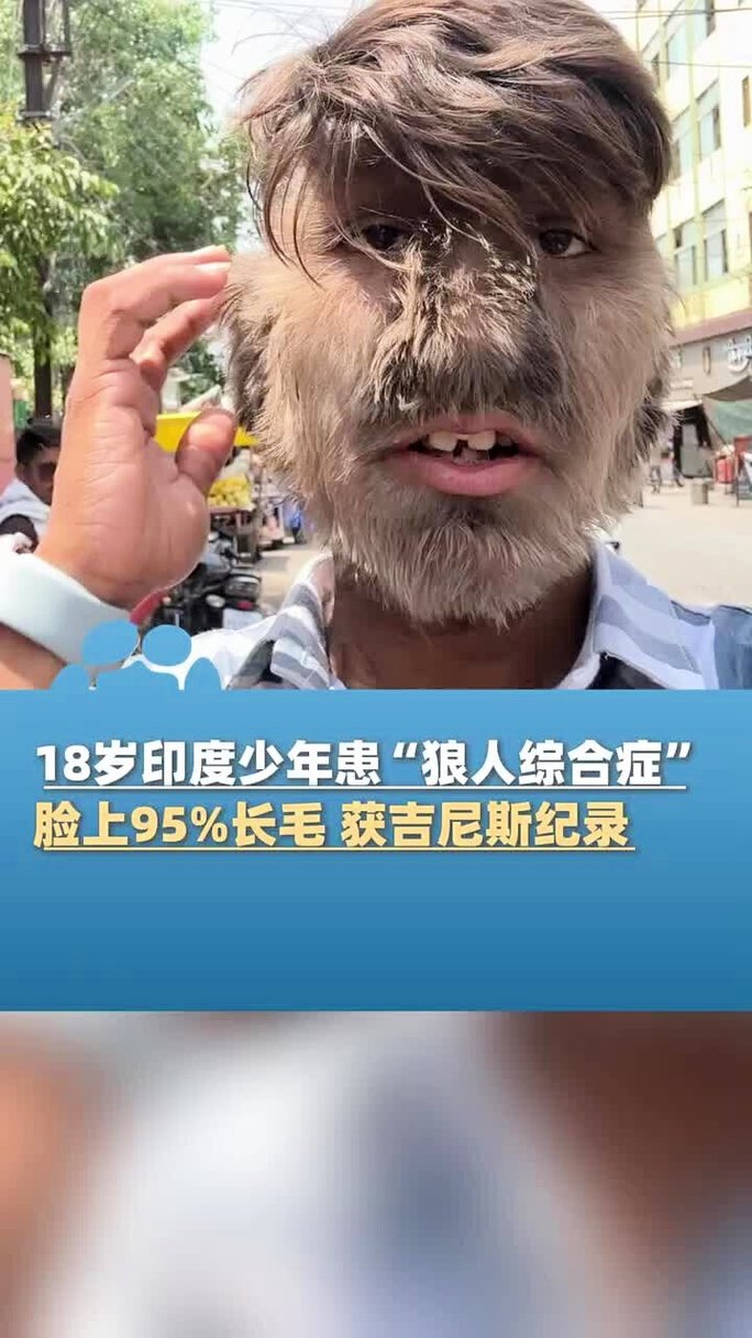 超久久久精品的相关介绍